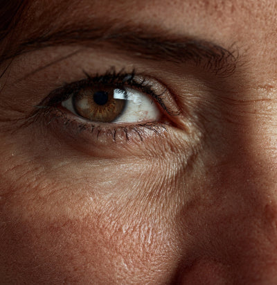 Close-up of a person's eye with detailed skin texture.