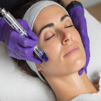 Woman receiving a micro needling facials