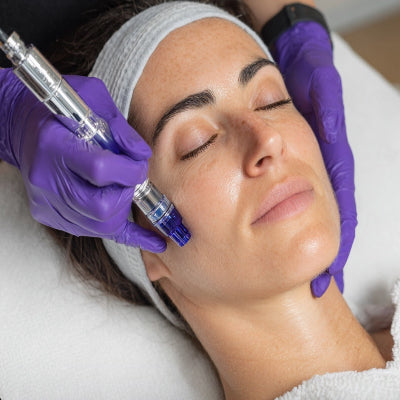 Woman receiving a micro needling facials