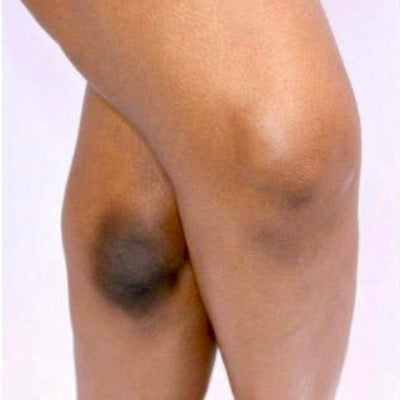 Knee & Feet treatment